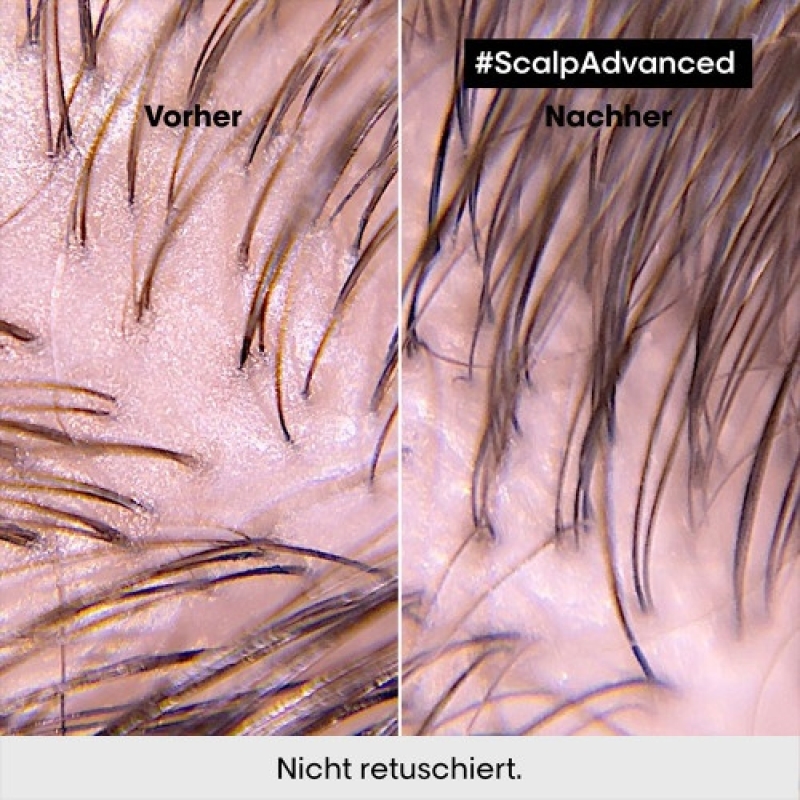 L'Oréal Professionnel Paris Serie Expert Scalp Advanced Anti-Discomfort Intese Soother Treatment 200ml