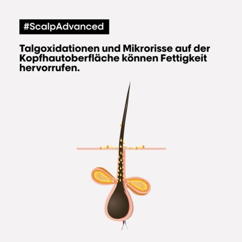 L'Oréal Professionnel Paris Serie Expert Scalp Advanced Anti-Discomfort Intese Soother Treatment 200ml